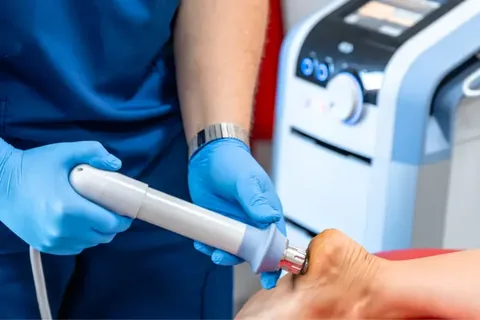 Aplicação de ondas de choque no pé, com o aparelho de terapia extracorpórea ao lado